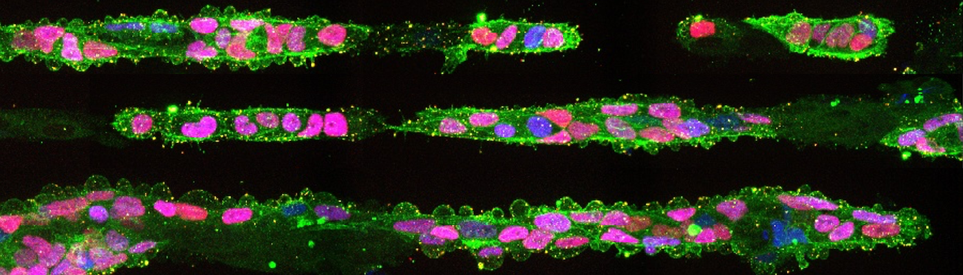 Deciphering Human Germline Development